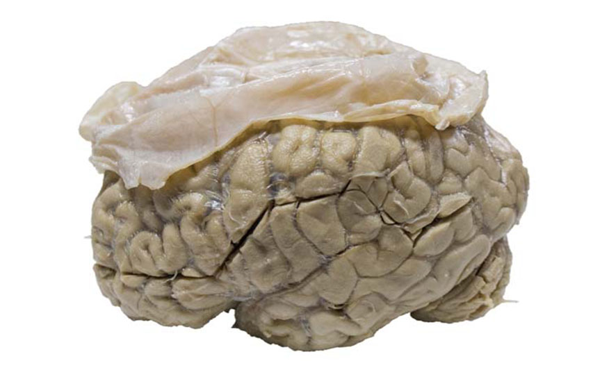 Cerebro que en la parte superior tiene colocada una capa algo arrugada y delgada de color rosado muy pálido